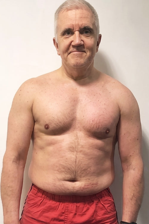 Before and after NovaPrime