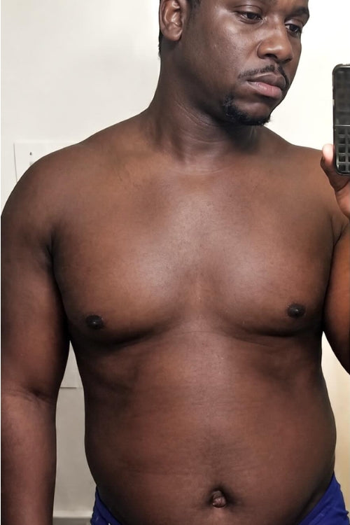 Before and after NovaPrime